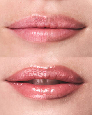 Lip Combo