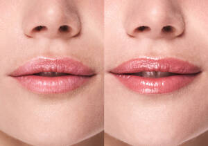 Lip Gloss