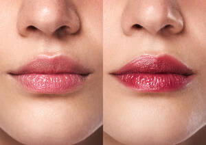Lip Gloss
